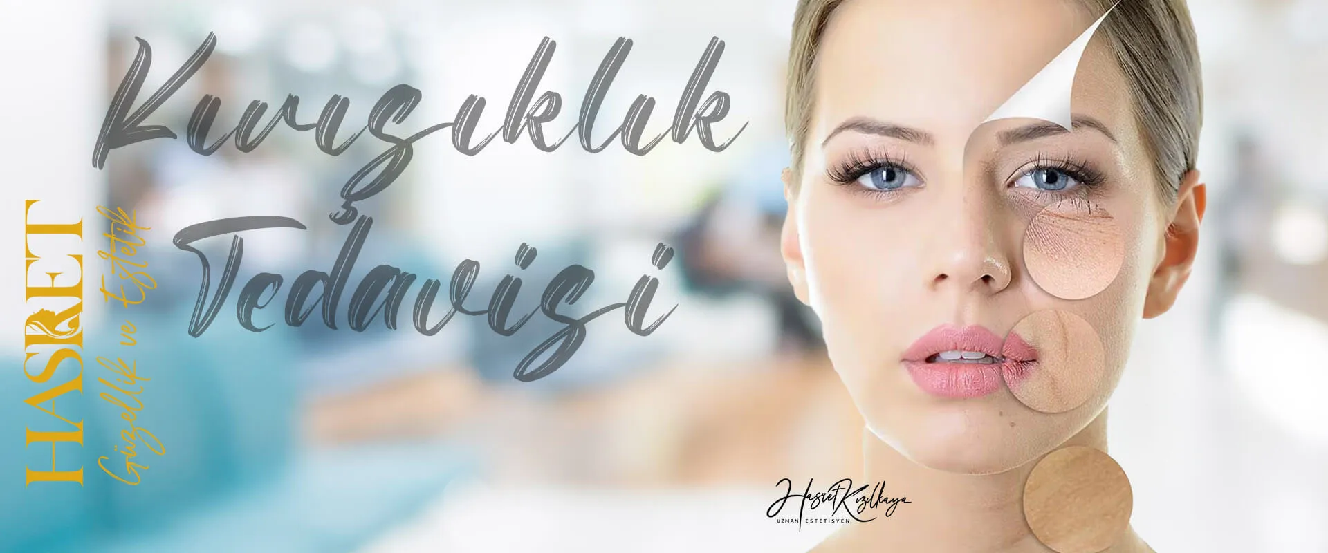Kırışıklık Tedavisi